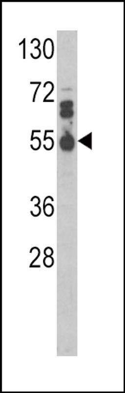 Western blot analysis of IL17RB Antibody in MDA-MB468 cell line lysates (35ug/lane)