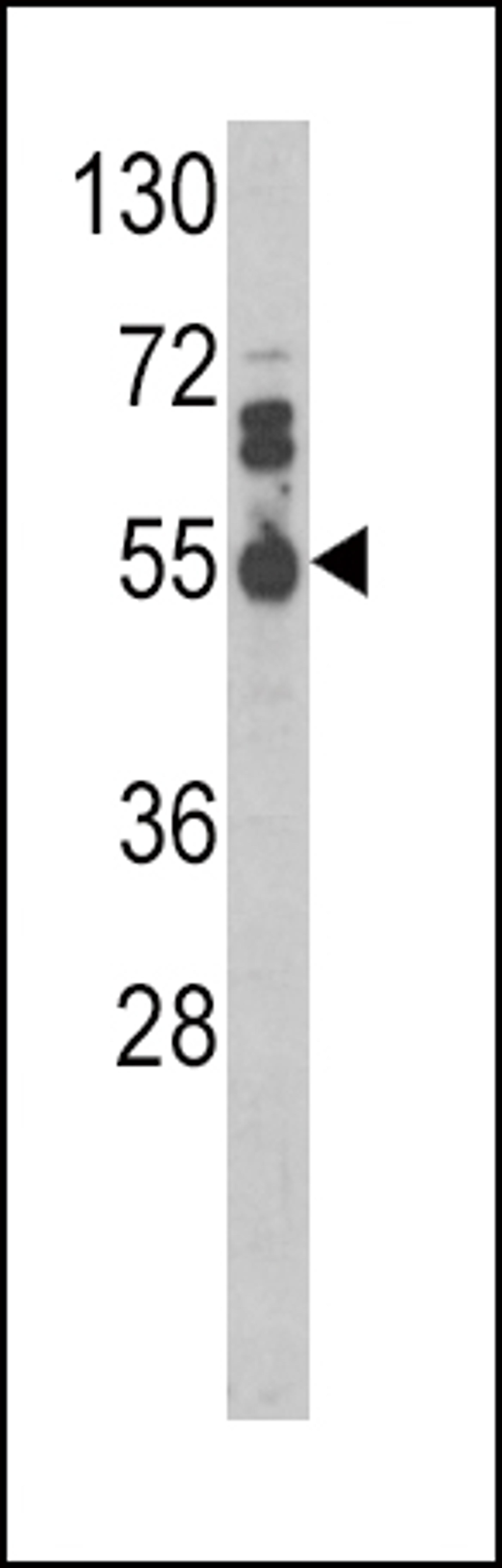 Western blot analysis of IL17RB Antibody in MDA-MB468 cell line lysates (35ug/lane)