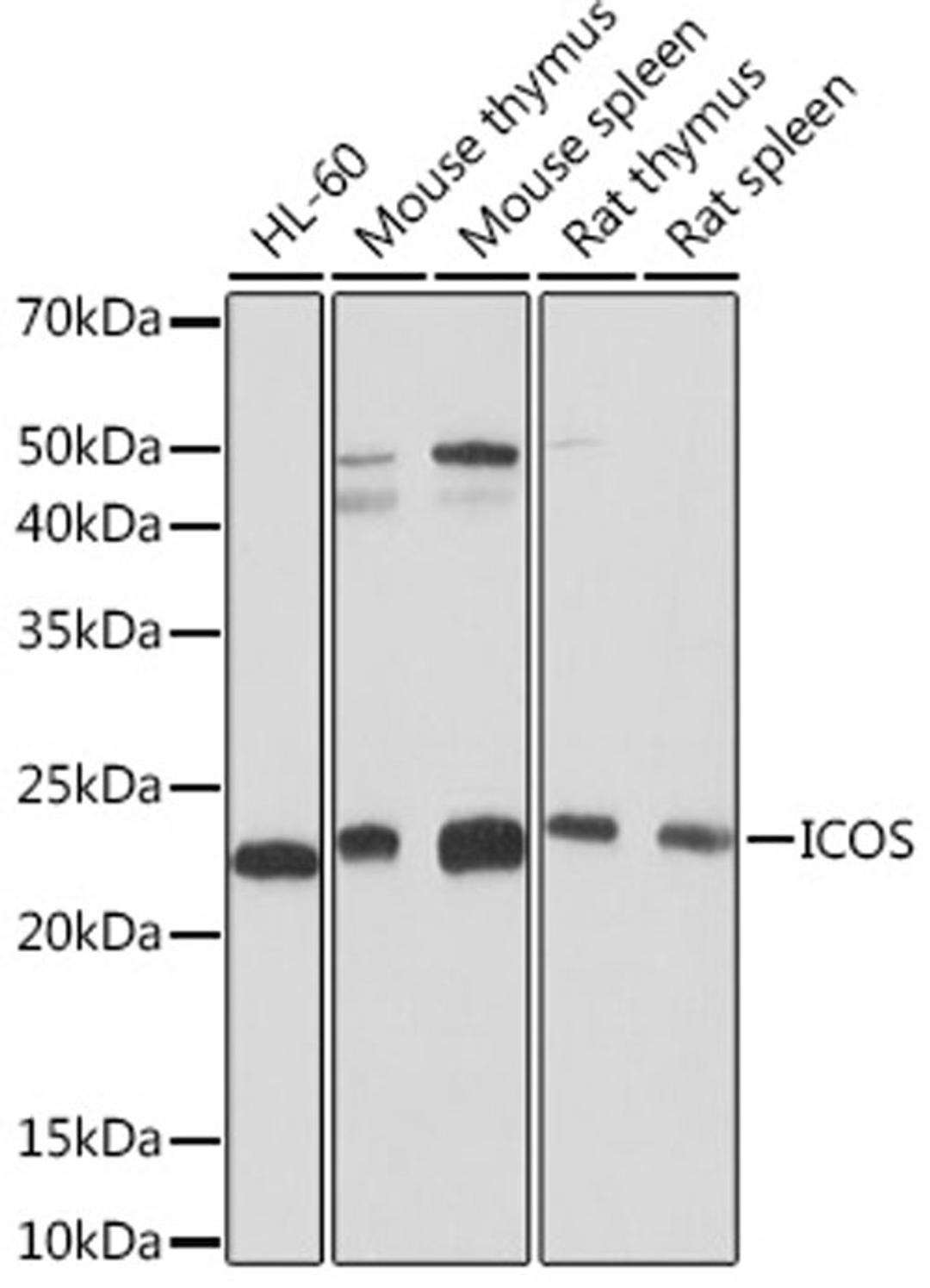 Western blot - ICOS Rabbit mAb (A5130)