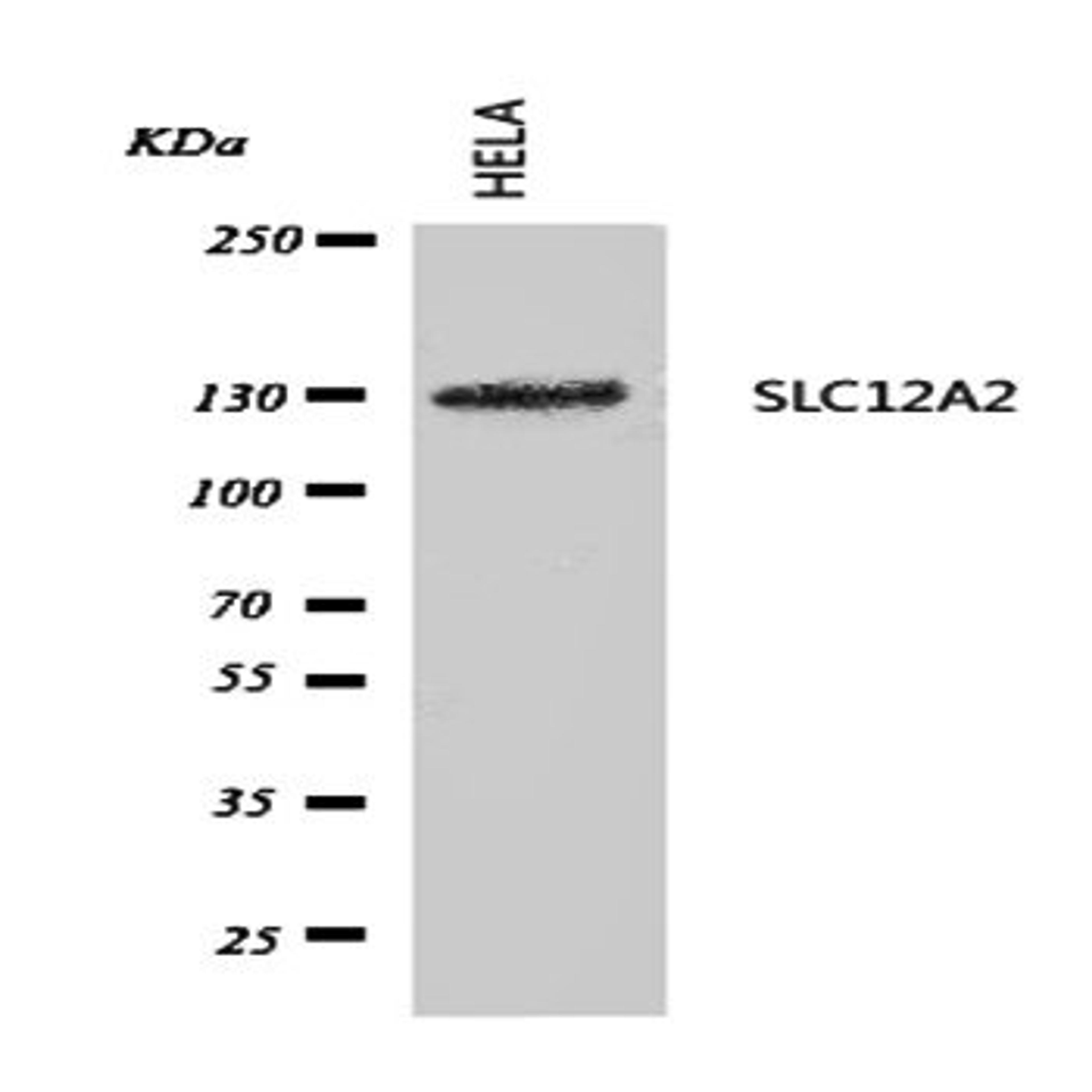 Western blot analysis of HELA Cell Lysate using SLC12A2 antibody