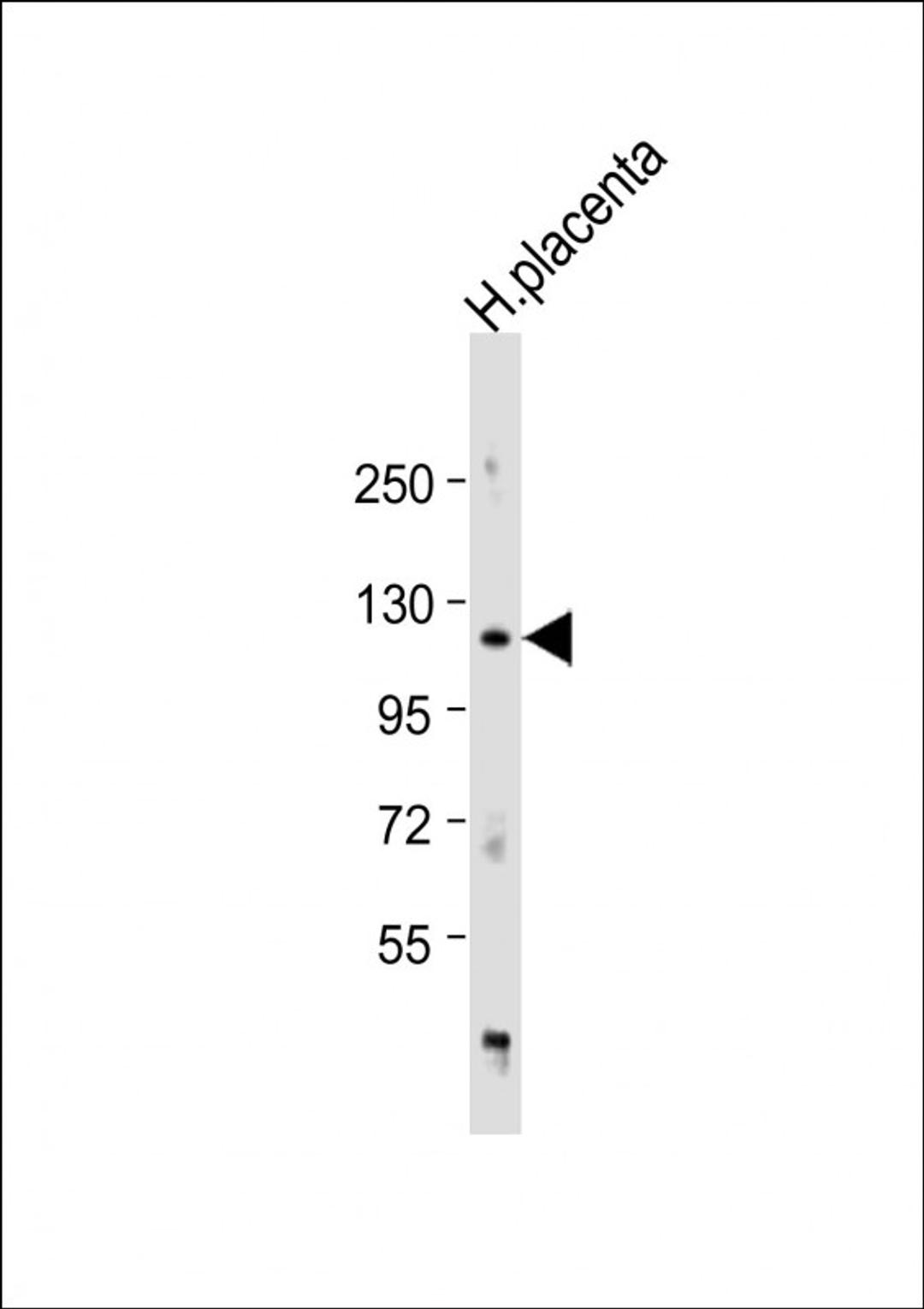 Western Blot at 1:1000 dilution + human placenta lysate Lysates/proteins at 20 ug per lane.