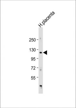 Western Blot at 1:1000 dilution + human placenta lysate Lysates/proteins at 20 ug per lane.