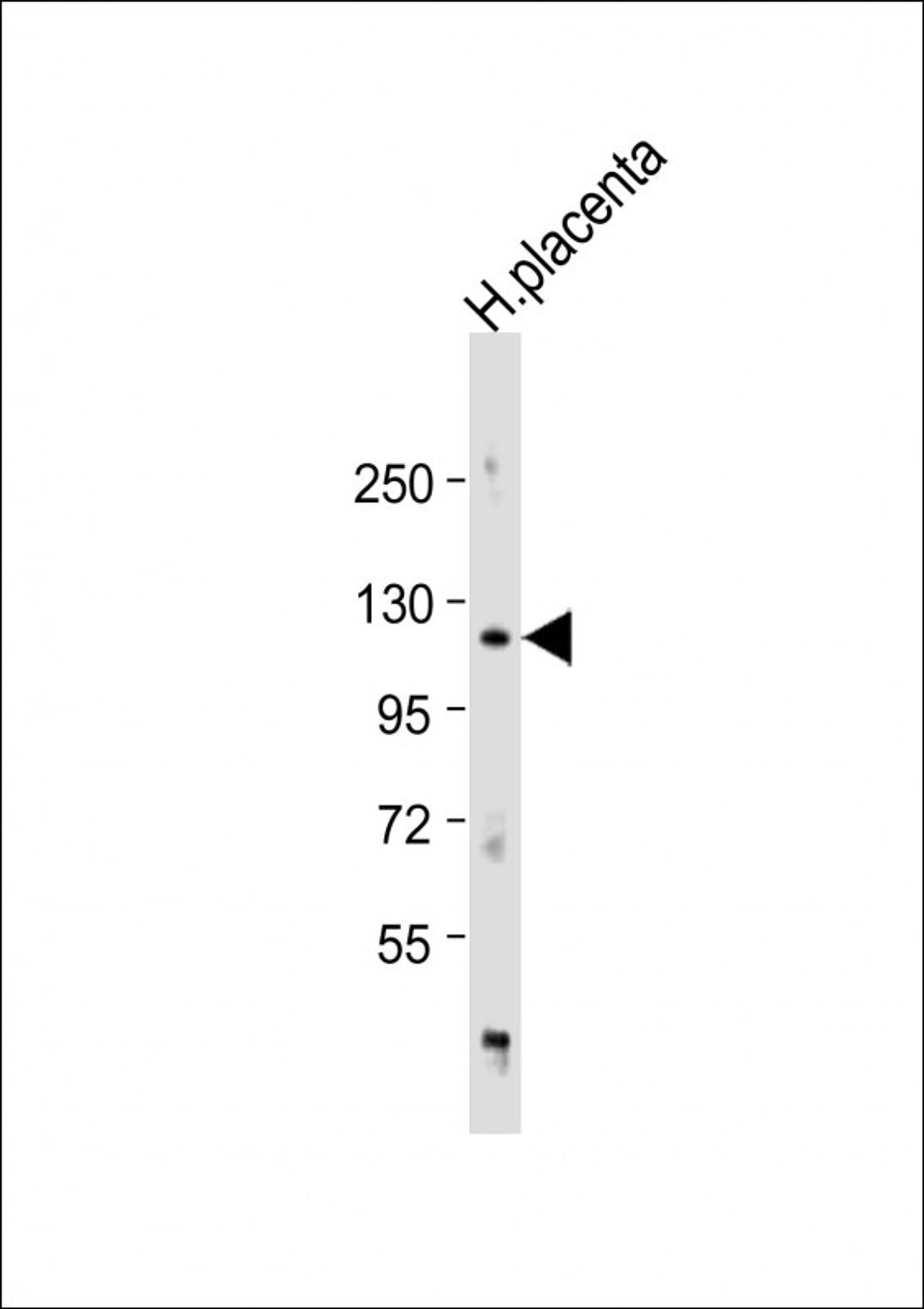 Western Blot at 1:1000 dilution + human placenta lysate Lysates/proteins at 20 ug per lane.