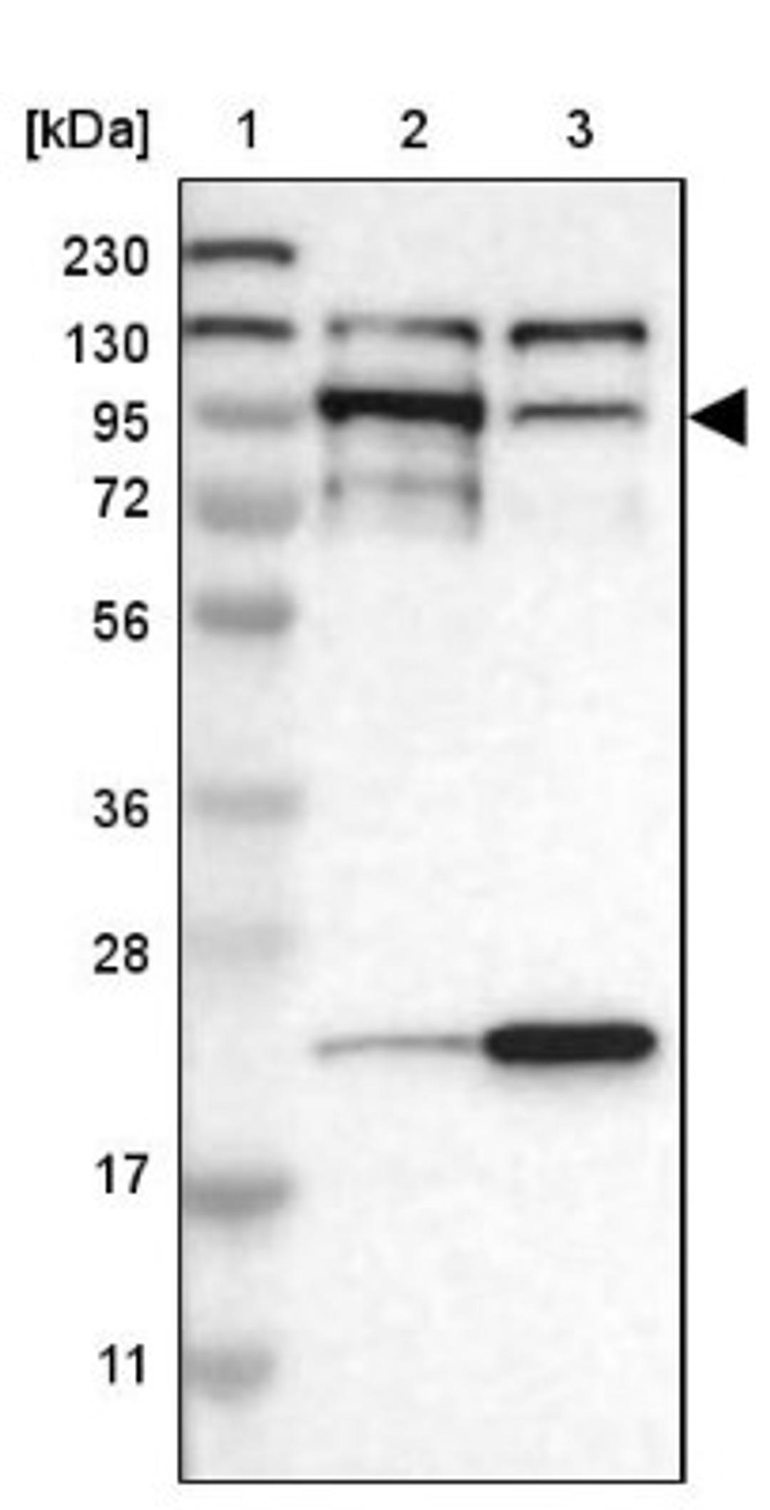 Western Blot: eIF4ENIF1 Antibody [NBP1-89390] - Lane 1: Marker [kDa] 230, 130, 95, 72, 56, 36, 28, 17, 11<br/>Lane 2: Human cell line RT-4<br/>Lane 3: Human cell line U-251MG sp