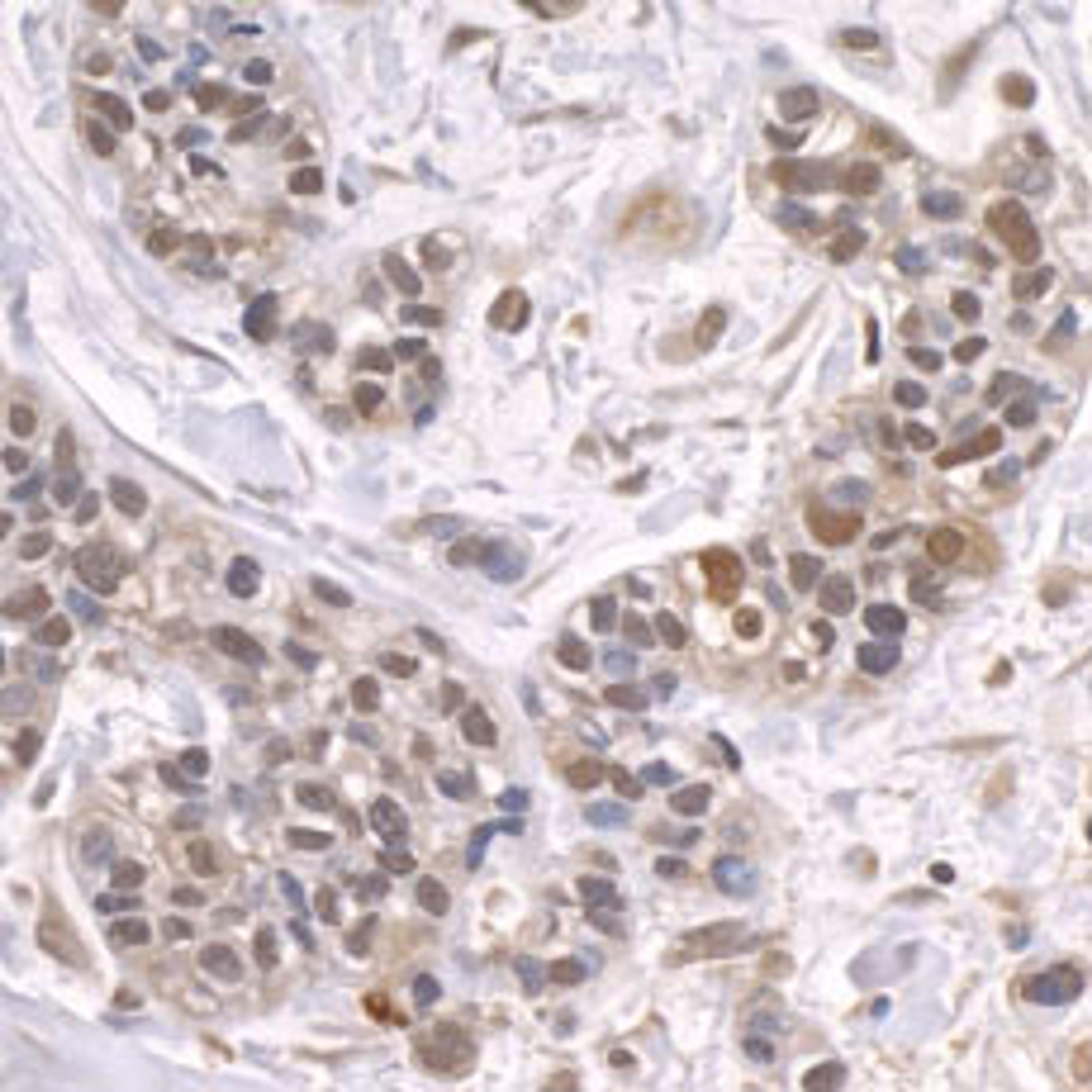 Detection of human ZFP106 by immunohistochemistry.