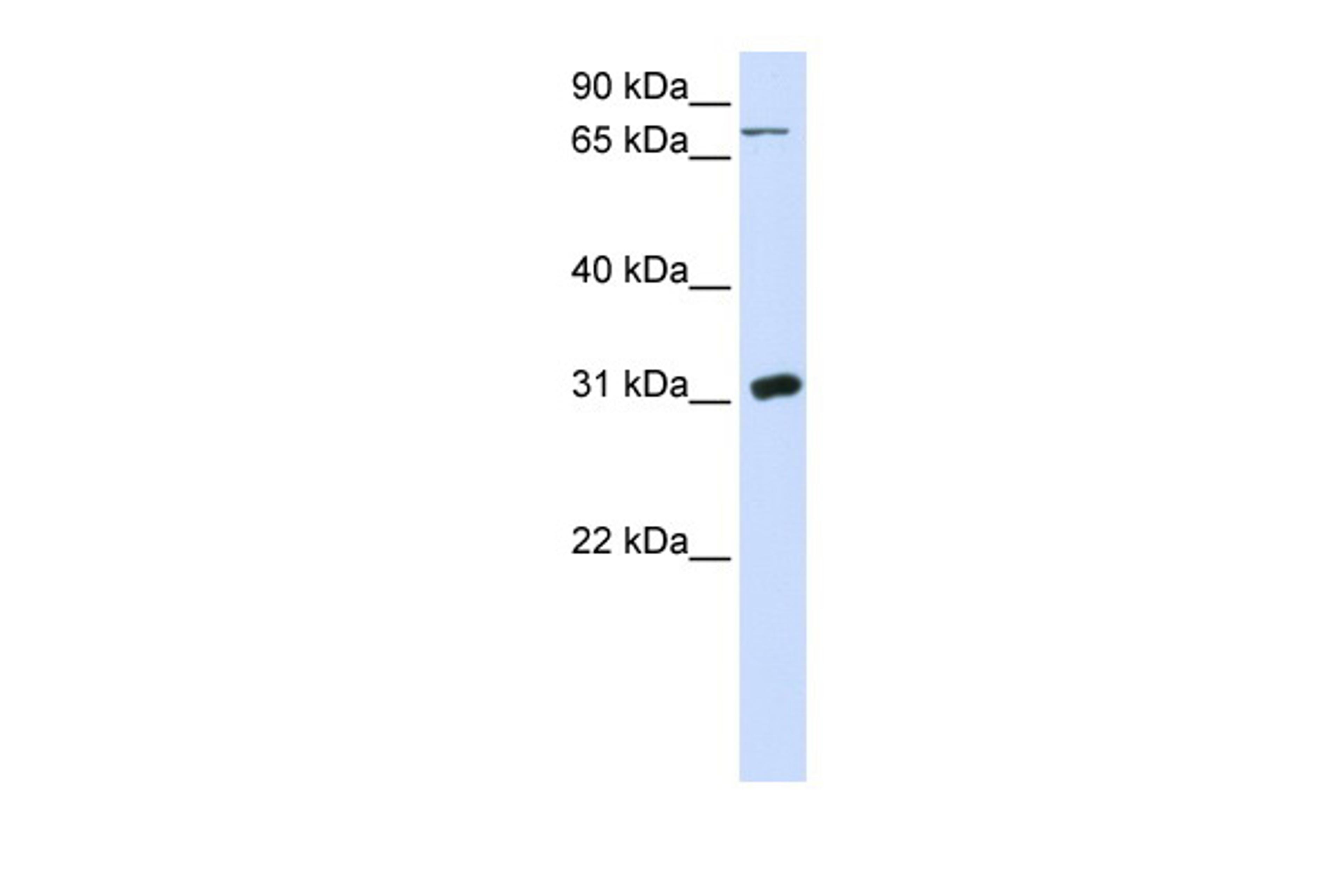 Antibody used in WB on Human 293T at 0.2-1 ug/ml.