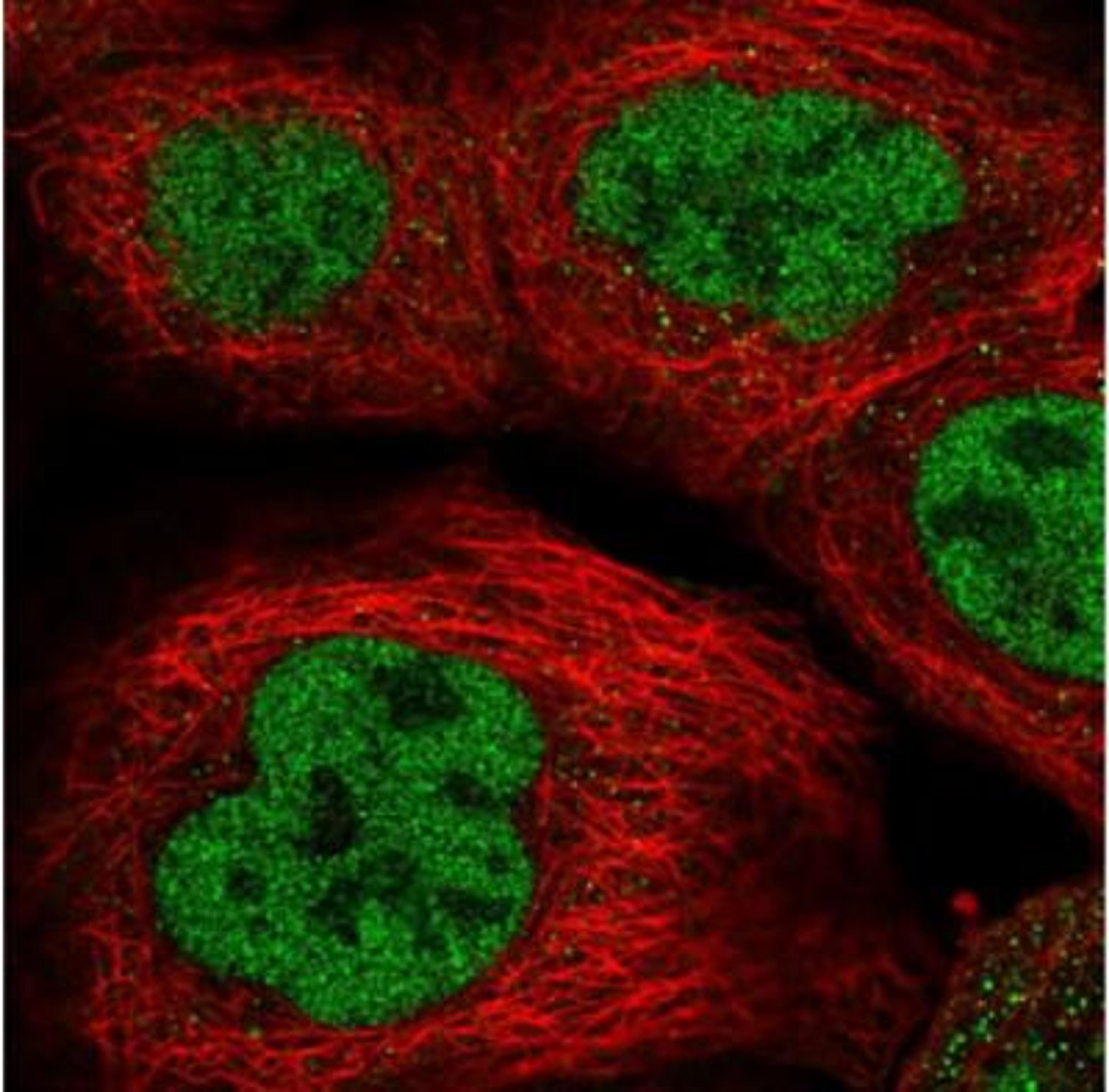 Immunocytochemistry/Immunofluorescence: RREB1 Antibody [NBP1-81726] - Immunofluorescent staining of human cell line A-431 shows positivity in nucleus but not nucleoli. Antibody staining is shown in green.