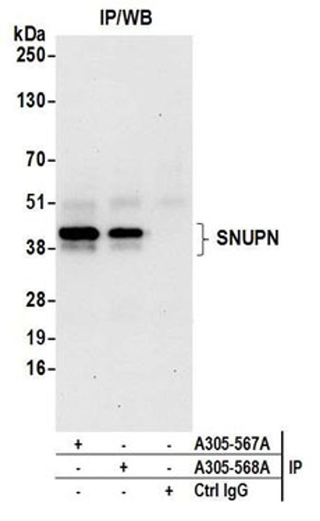 Detection of human SNUPN by western blot of immunoprecipitates.