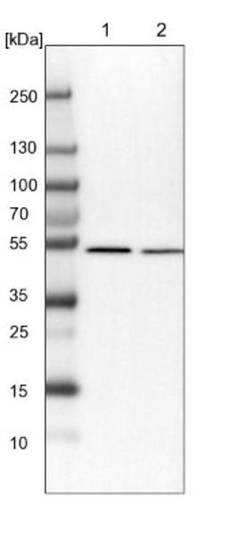 Western Blot: QRSL Antibody [NBP1-87992] - Lane 1: NIH-3T3 cell lysate (Mouse embryonic fibroblast cells)<br/>Lane 2: NBT-II cell lysate (Rat Wistar bladder tumour cells)