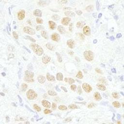 Detection of human MAZ/SAF-1 by immunohistochemistry.