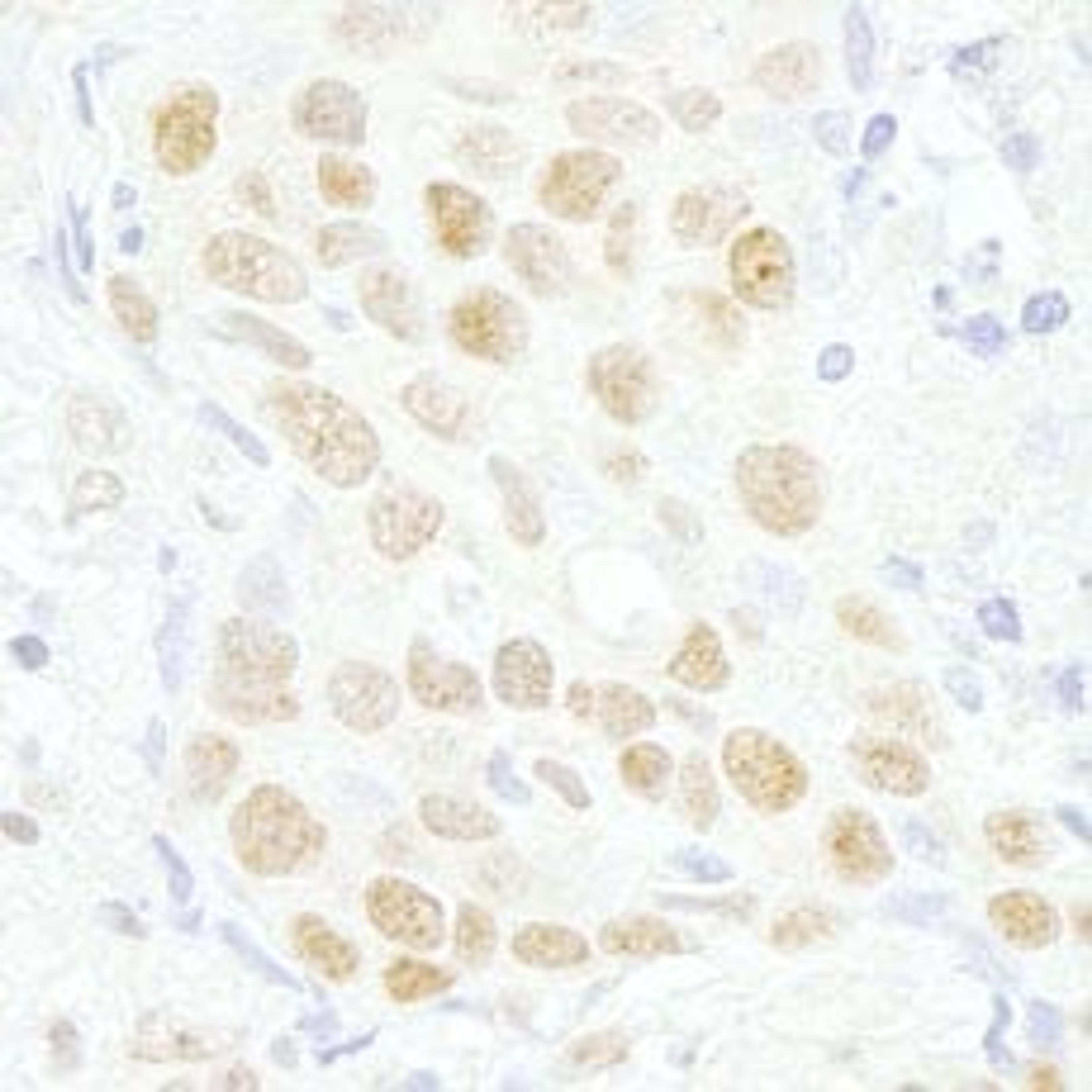 Detection of human MAZ/SAF-1 by immunohistochemistry.