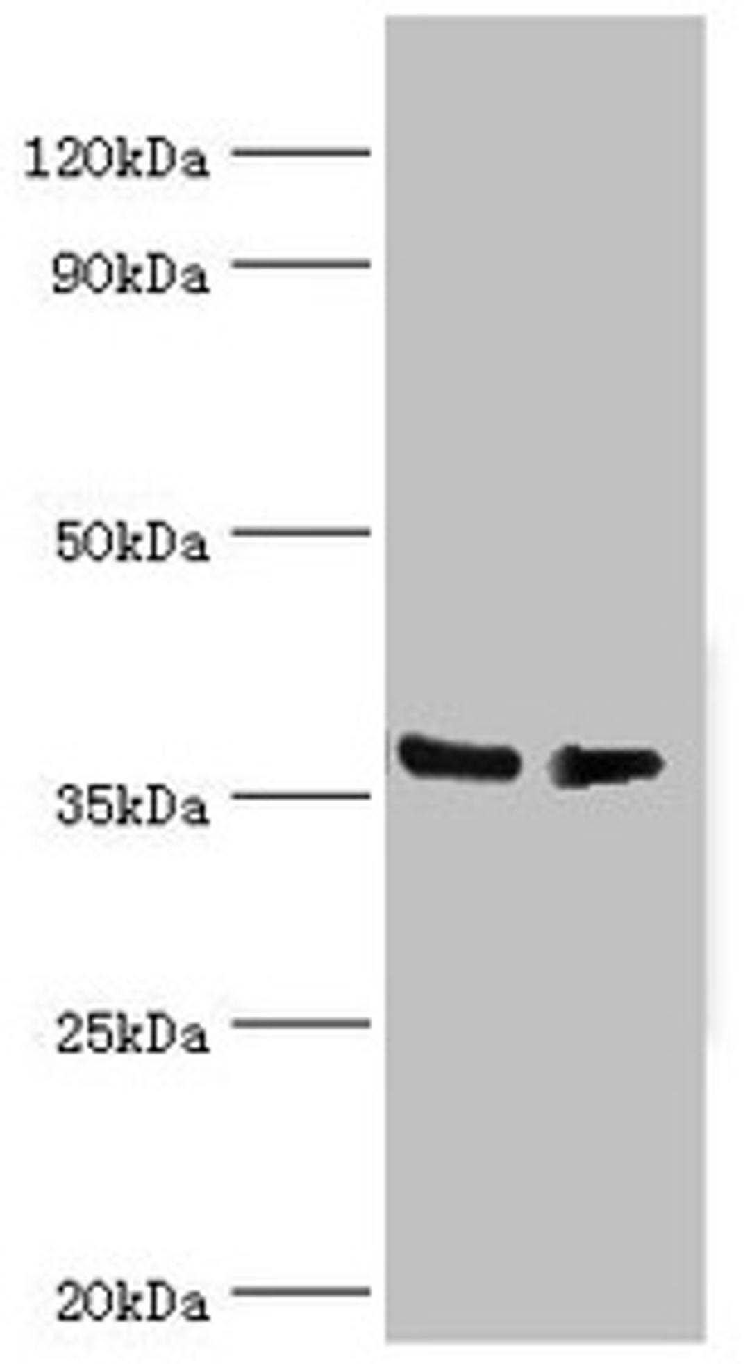 Western blot. All lanes: HNRNPD antibody at 4µg/ml. Lane 1: Hela whole cell lysate. Lane 2: 293T whole cell lysate. Secondary. Goat polyclonal to rabbit IgG at 1/10000 dilution. Predicted band size: 39, 37, 33, 31 kDa. Observed band size: 39 kDa