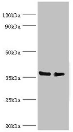 Western blot. All lanes: HNRNPD antibody at 4µg/ml. Lane 1: Hela whole cell lysate. Lane 2: 293T whole cell lysate. Secondary. Goat polyclonal to rabbit IgG at 1/10000 dilution. Predicted band size: 39, 37, 33, 31 kDa. Observed band size: 39 kDa