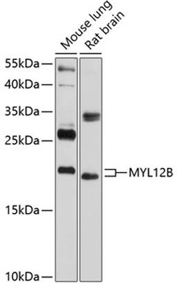 Western blot - MYL12B antibody (A5104)