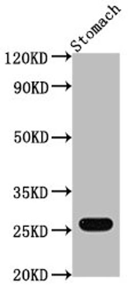 Western Blot. Positive WB detected in: Mouse stomach tissue. All lanes: Gsta1 antibody at 1:2000. Secondary. Goat polyclonal to rabbit IgG at 1/50000 dilution. Predicted band size: 26 kDa. Observed band size: 26 kDa. 