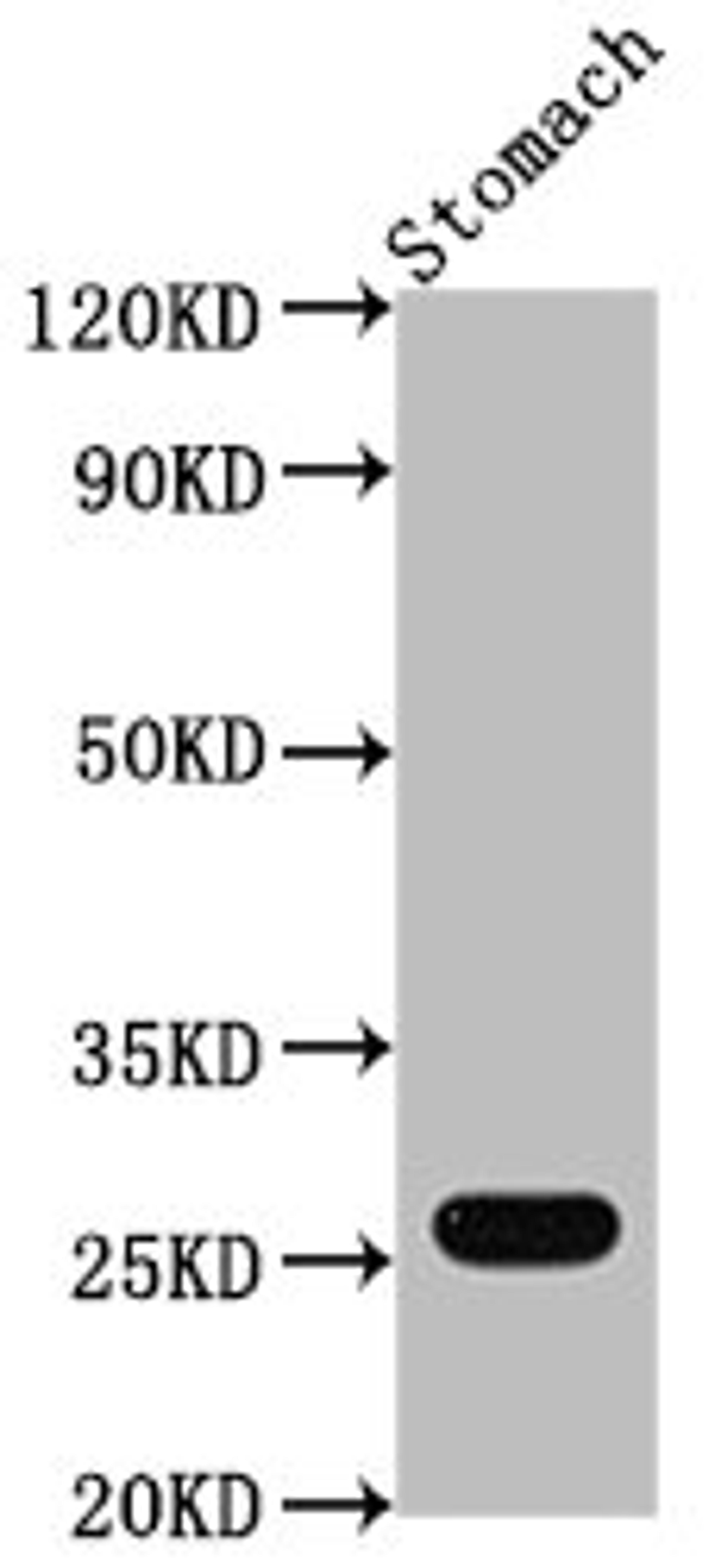 Western Blot. Positive WB detected in: Mouse stomach tissue. All lanes: Gsta1 antibody at 1:2000. Secondary. Goat polyclonal to rabbit IgG at 1/50000 dilution. Predicted band size: 26 kDa. Observed band size: 26 kDa. 