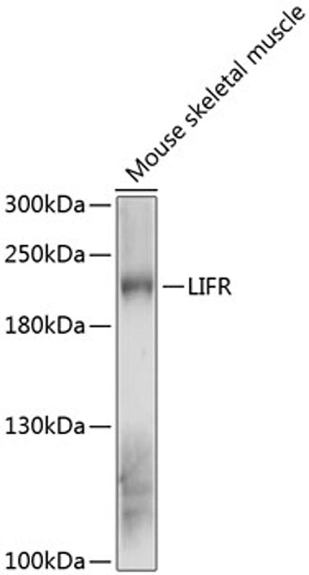 Western blot - LIFR antibody (A12783)