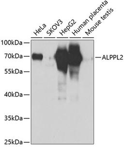 Western blot - ALPPL2 antibody (A6866)