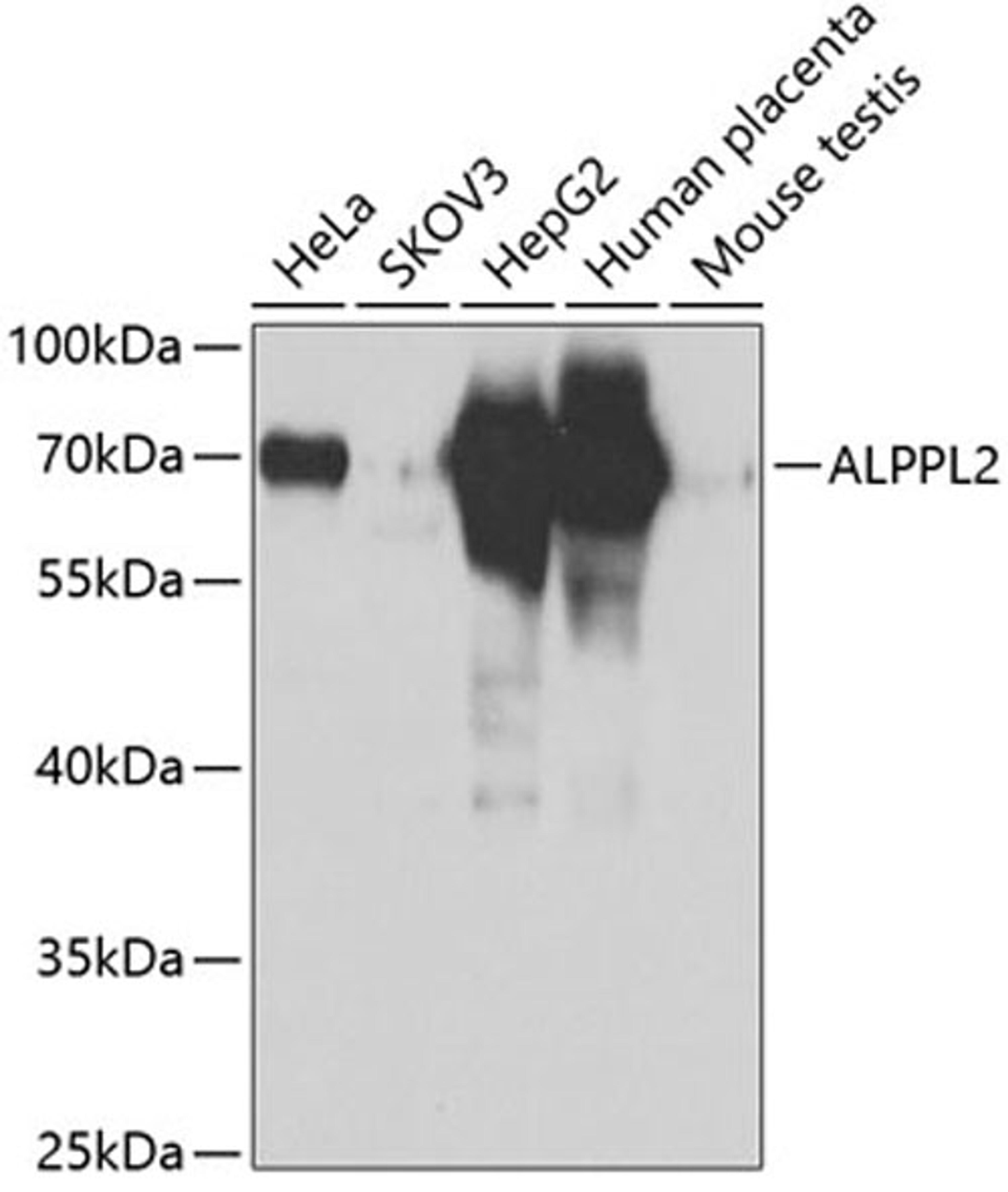 Western blot - ALPPL2 antibody (A6866)