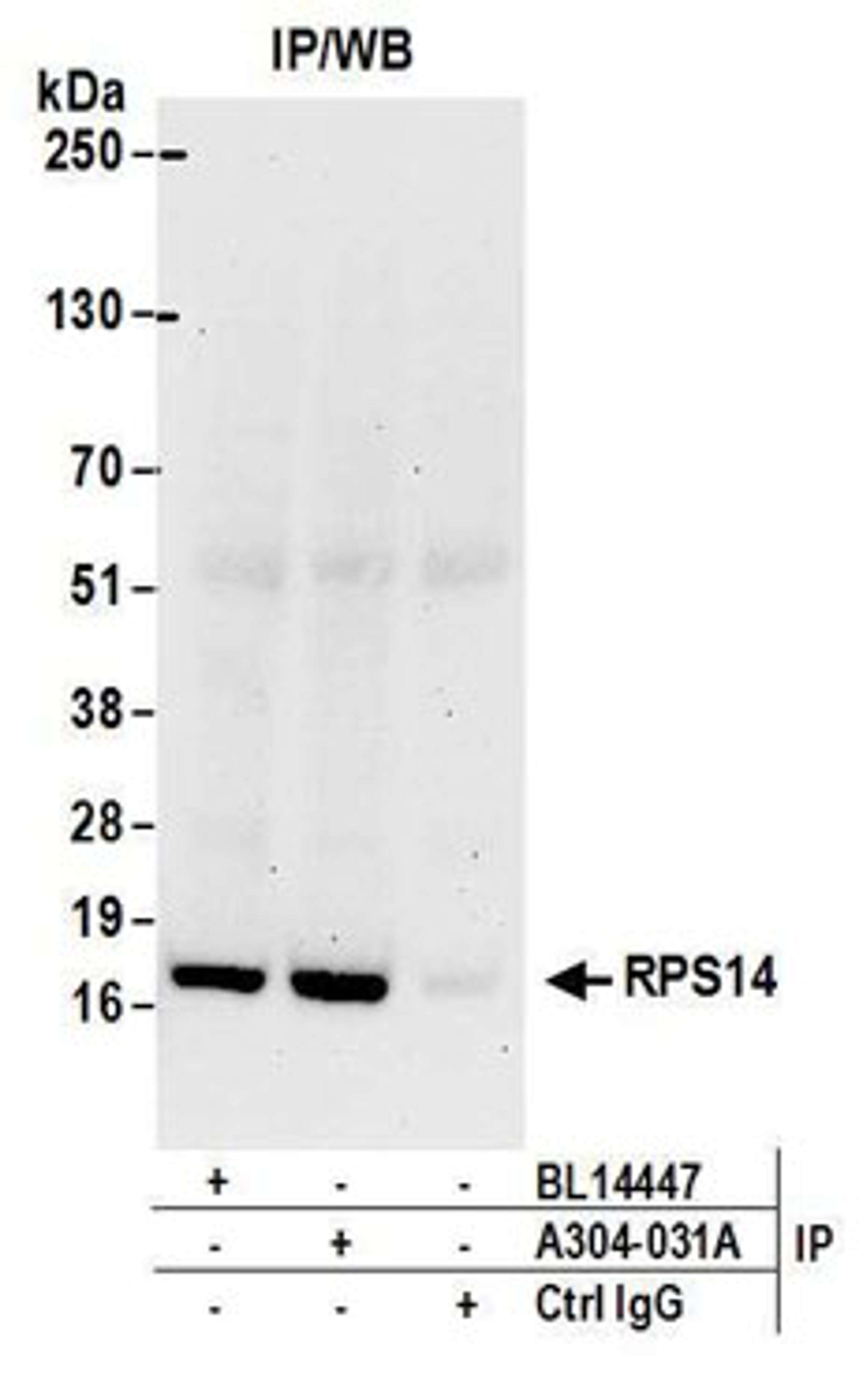 Detection of human RPS14 by western blot of immunoprecipitates.