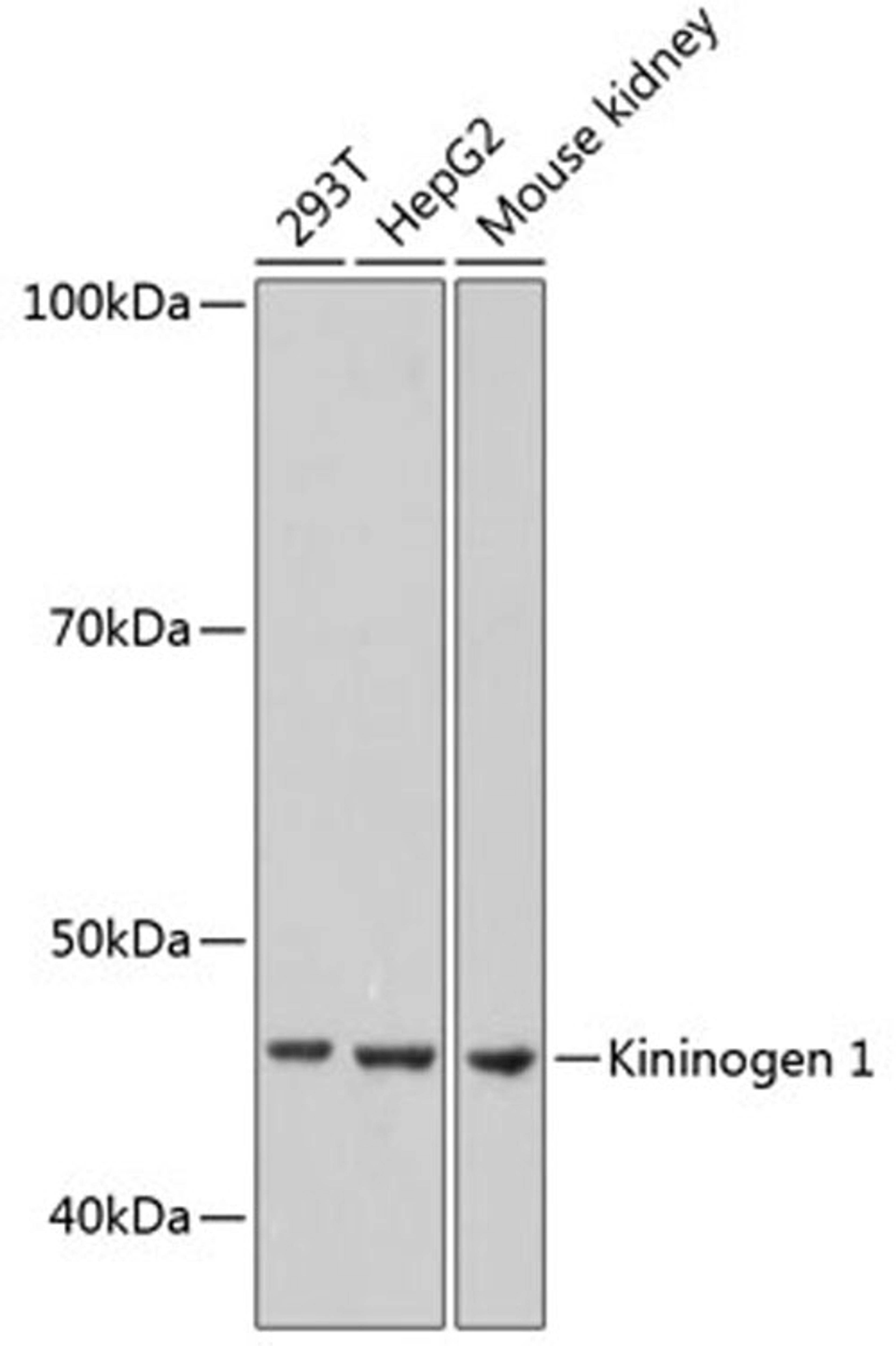 Western blot - Kininogen 1 Rabbit mAb (A11638)