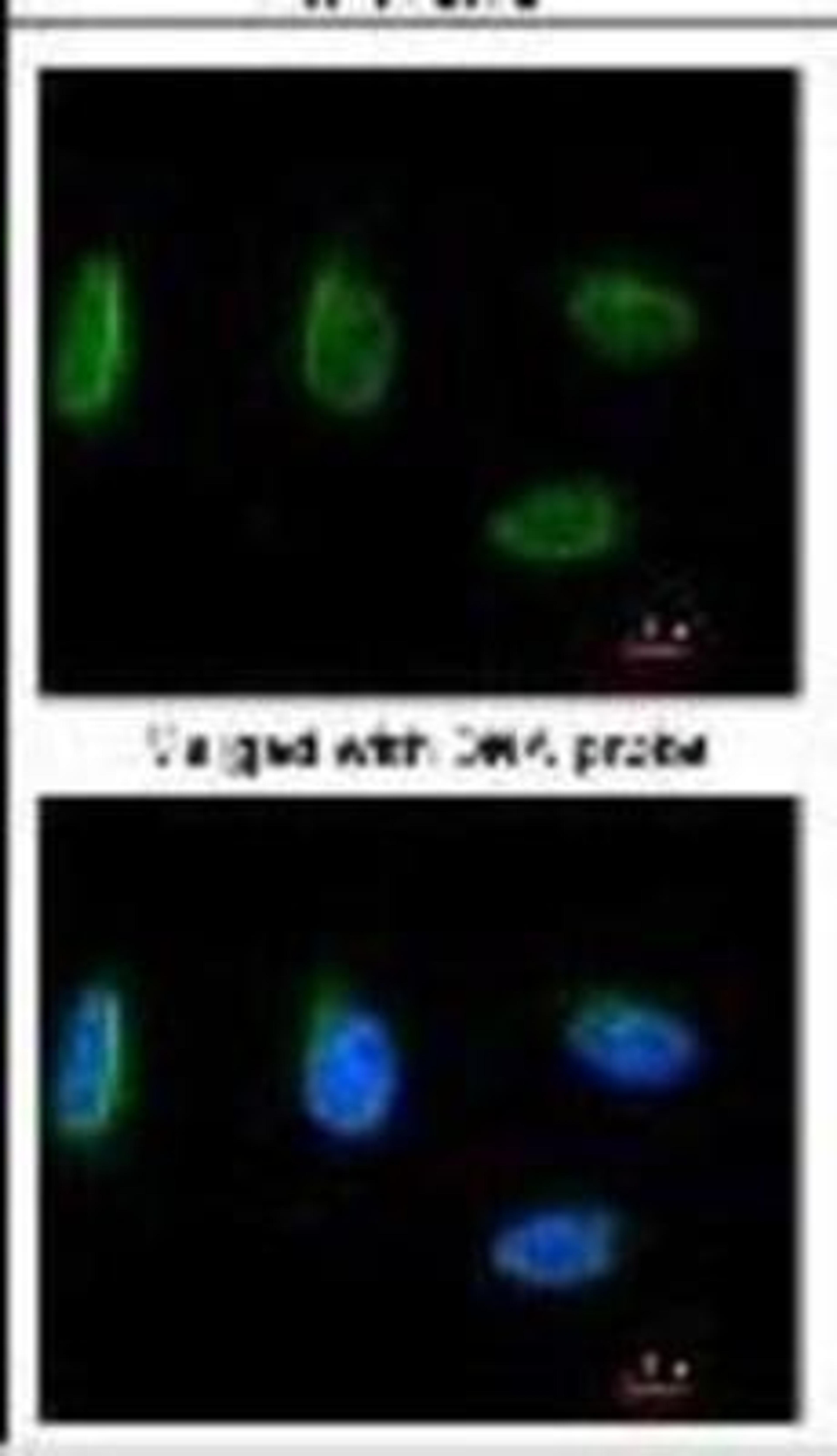 Immunocytochemistry/Immunofluorescence: NBS1 Antibody (1D7) [NB100-221] - Analysis of HeLa, using antibody at 1:100 dilution.