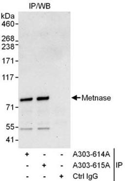 Detection of human Metnase by western blot of immunoprecipitates.