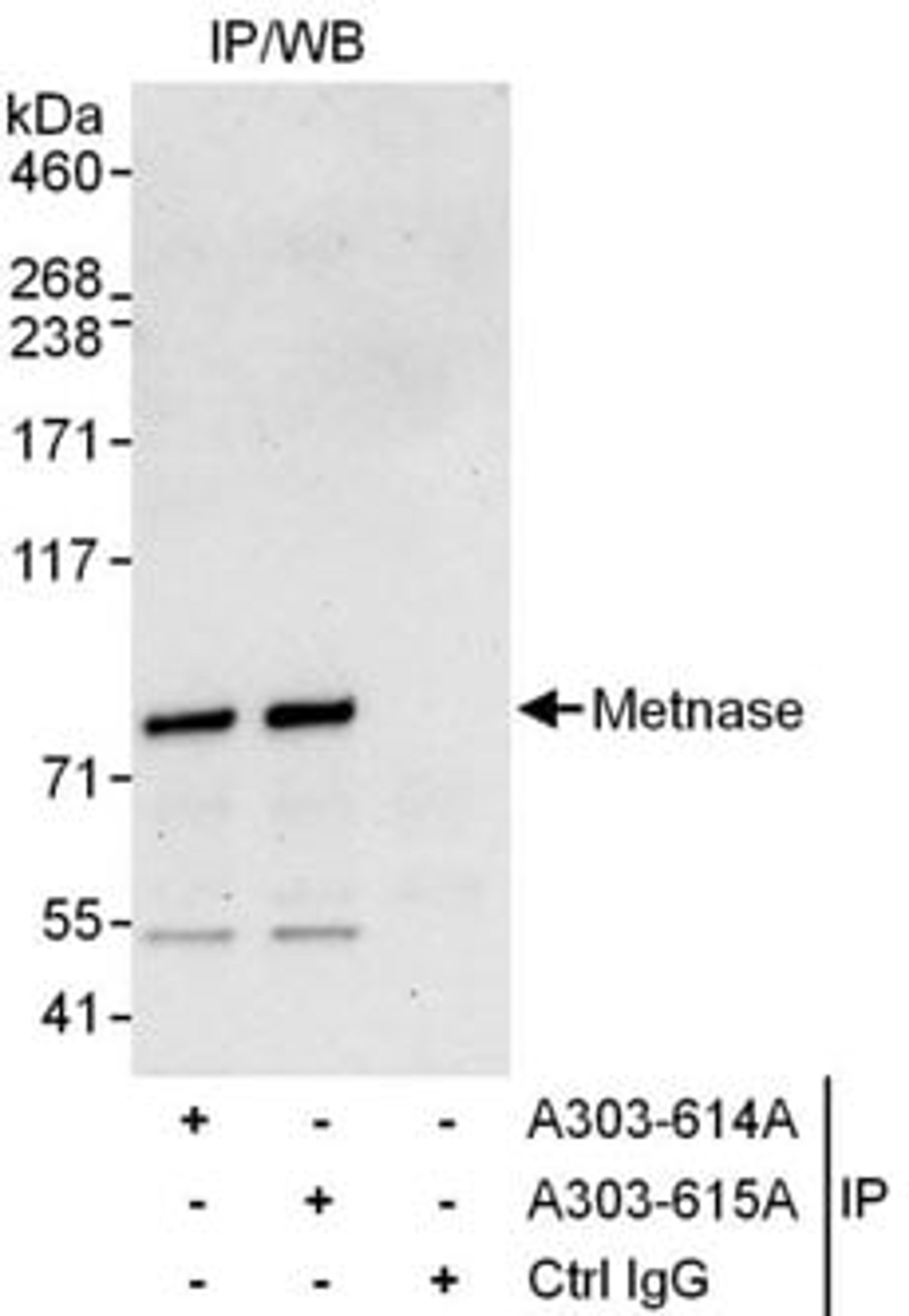 Detection of human Metnase by western blot of immunoprecipitates.