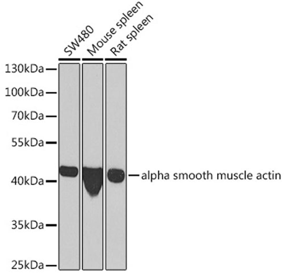 Western blot - alpha smooth muscle actin  antibody (A7248)