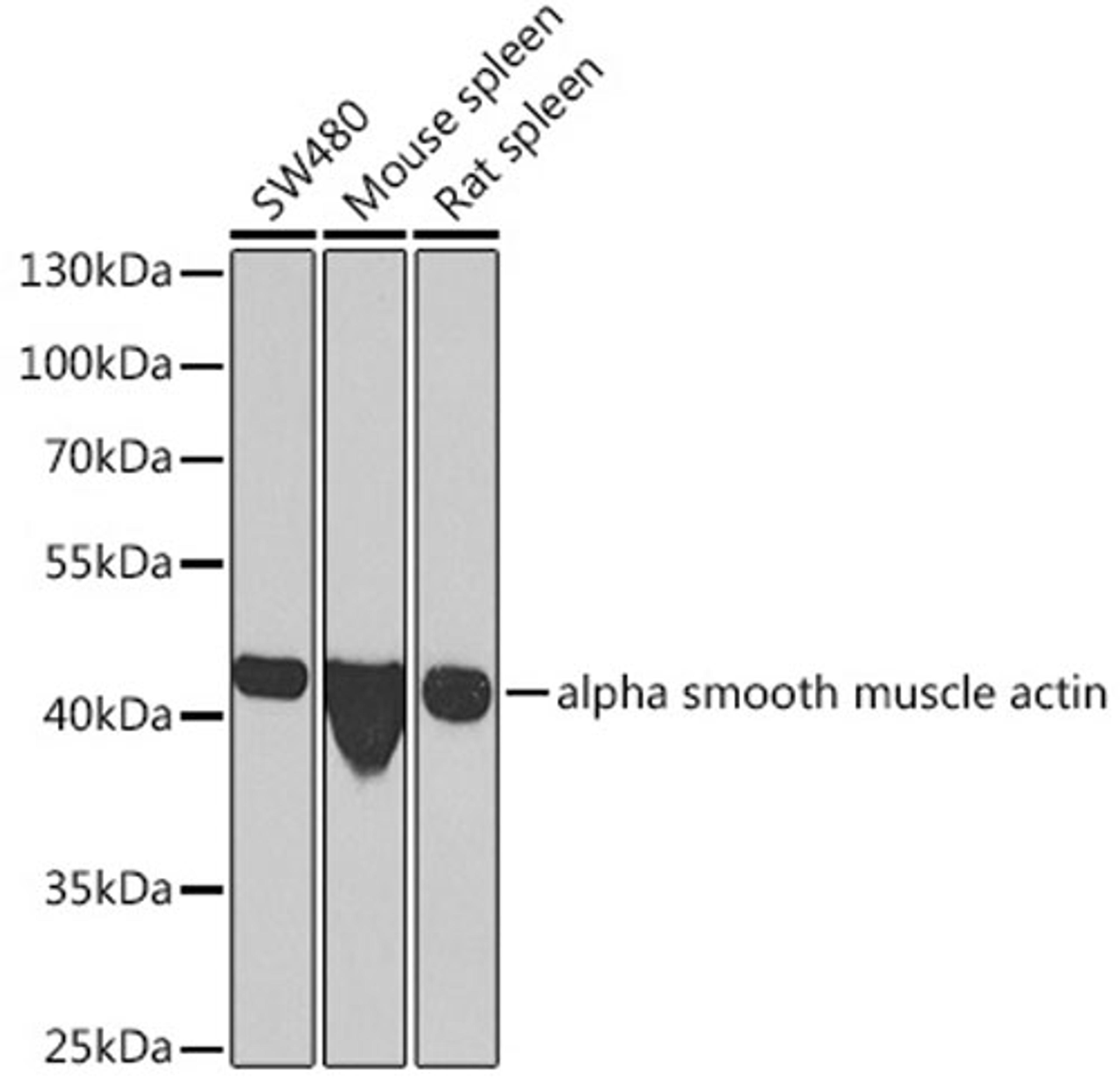 Western blot - alpha smooth muscle actin  antibody (A7248)