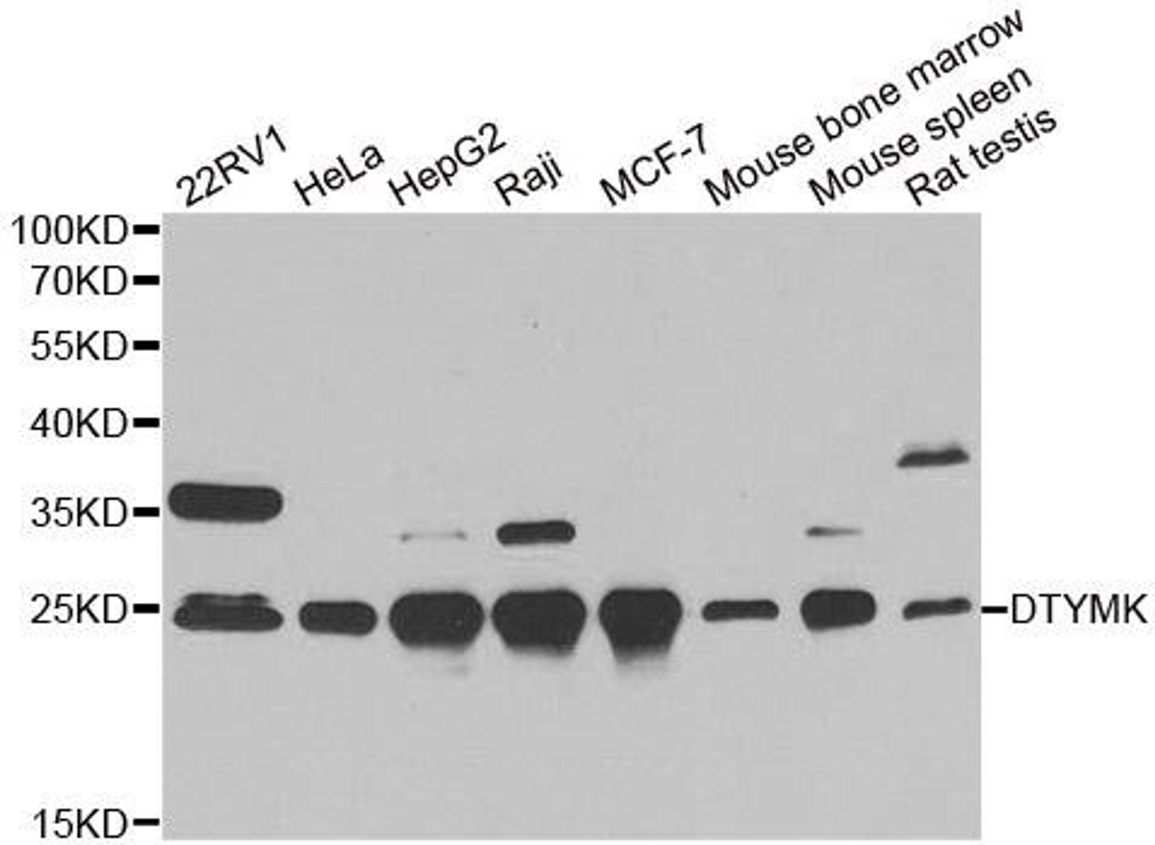 Western blot analysis of extracts of various cell lines using DTYMK antibody