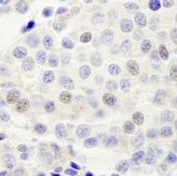 Detection of human INT4 by immunohistochemistry.