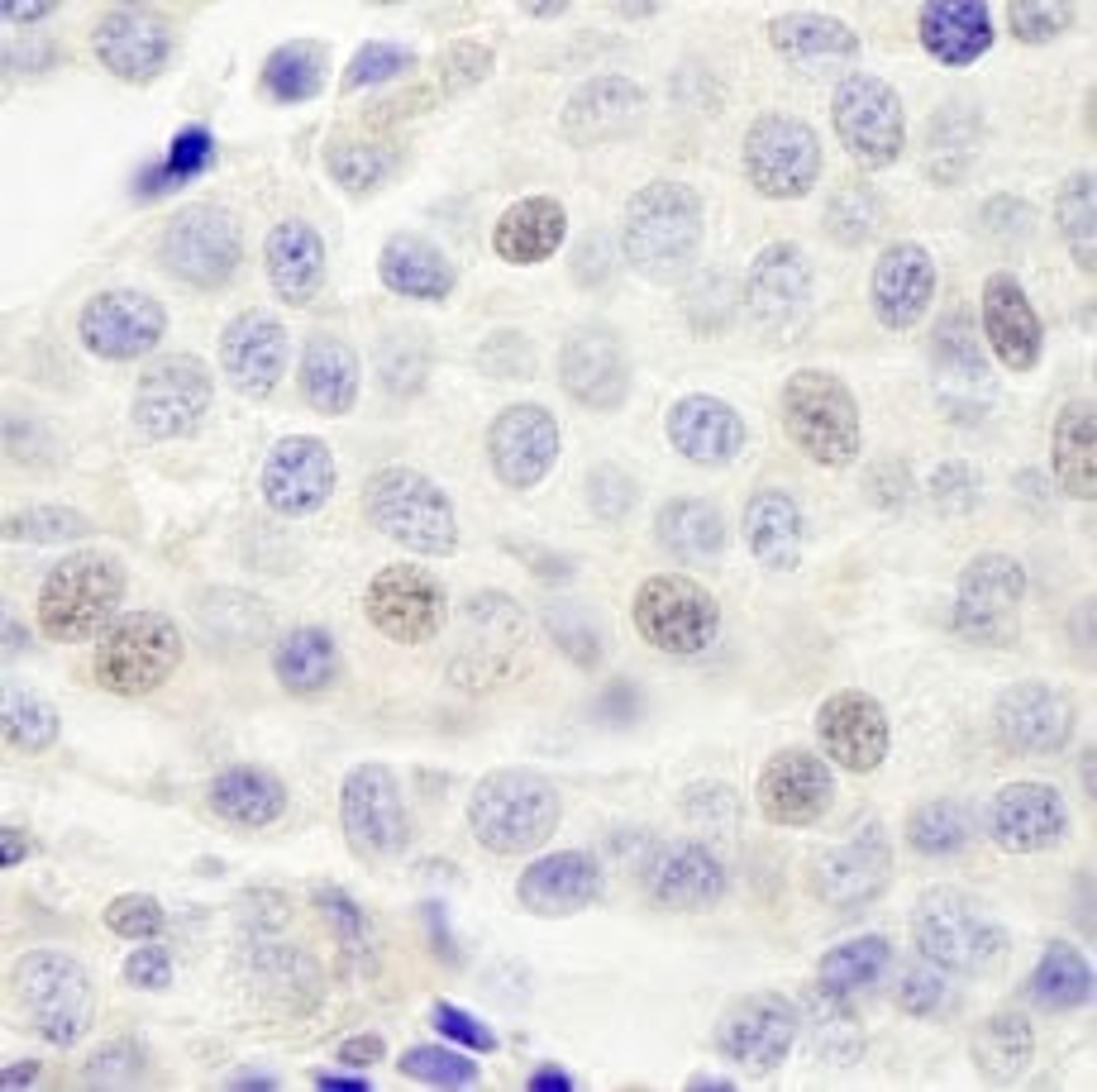 Detection of human INT4 by immunohistochemistry.