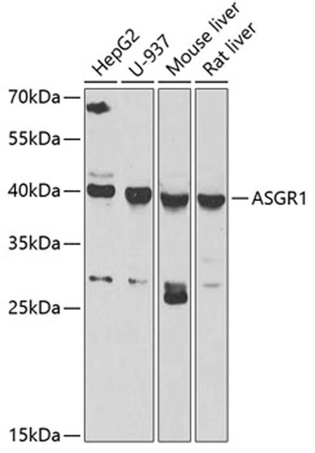 Western blot - ASGR1 antibody (A6871)