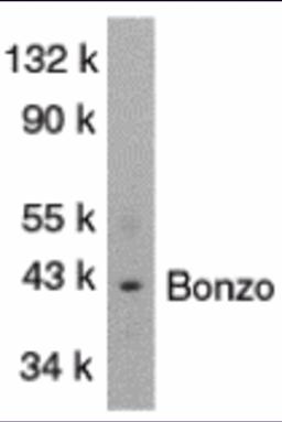 Loading: 15 &#956;g of cell lysates per lane.