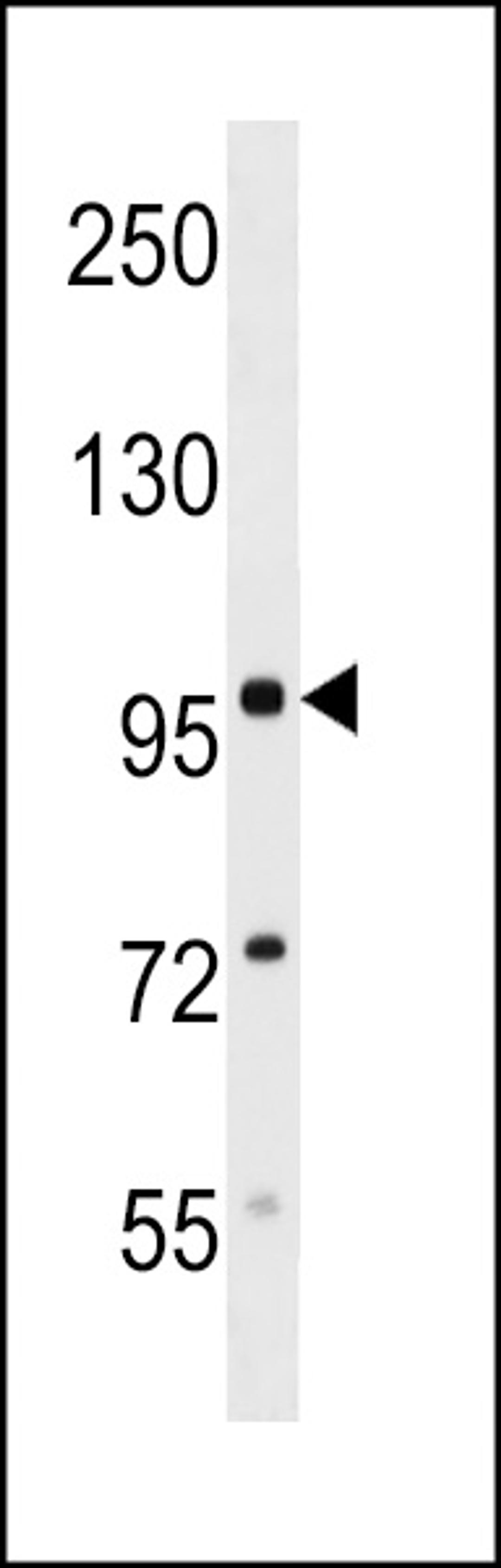 Western blot analysis in mouse kidney tissue lysates (35ug/lane).