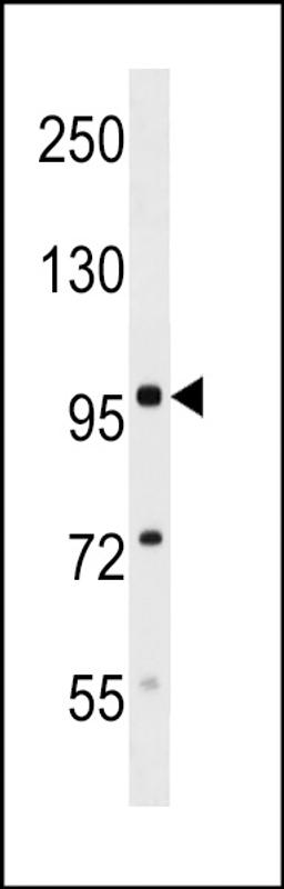 Western blot analysis in mouse kidney tissue lysates (35ug/lane).