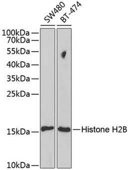 Western blot - Histone H2B antibody (A1958)