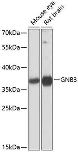 Western blot - GNB3 antibody (A1387)