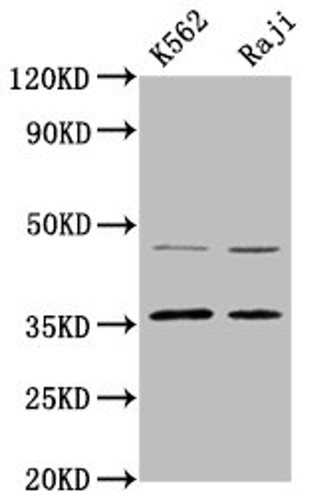 Western Blot. Positive WB detected in: K562 whole cell lysate, Raji whole cell lysate. All lanes: MAGEA2 antibody at 4.4ug/ml. Secondary. Goat polyclonal to rabbit IgG at 1/50000 dilution. Predicted band size: 36 kDa. Observed band size: 36 kDa. 