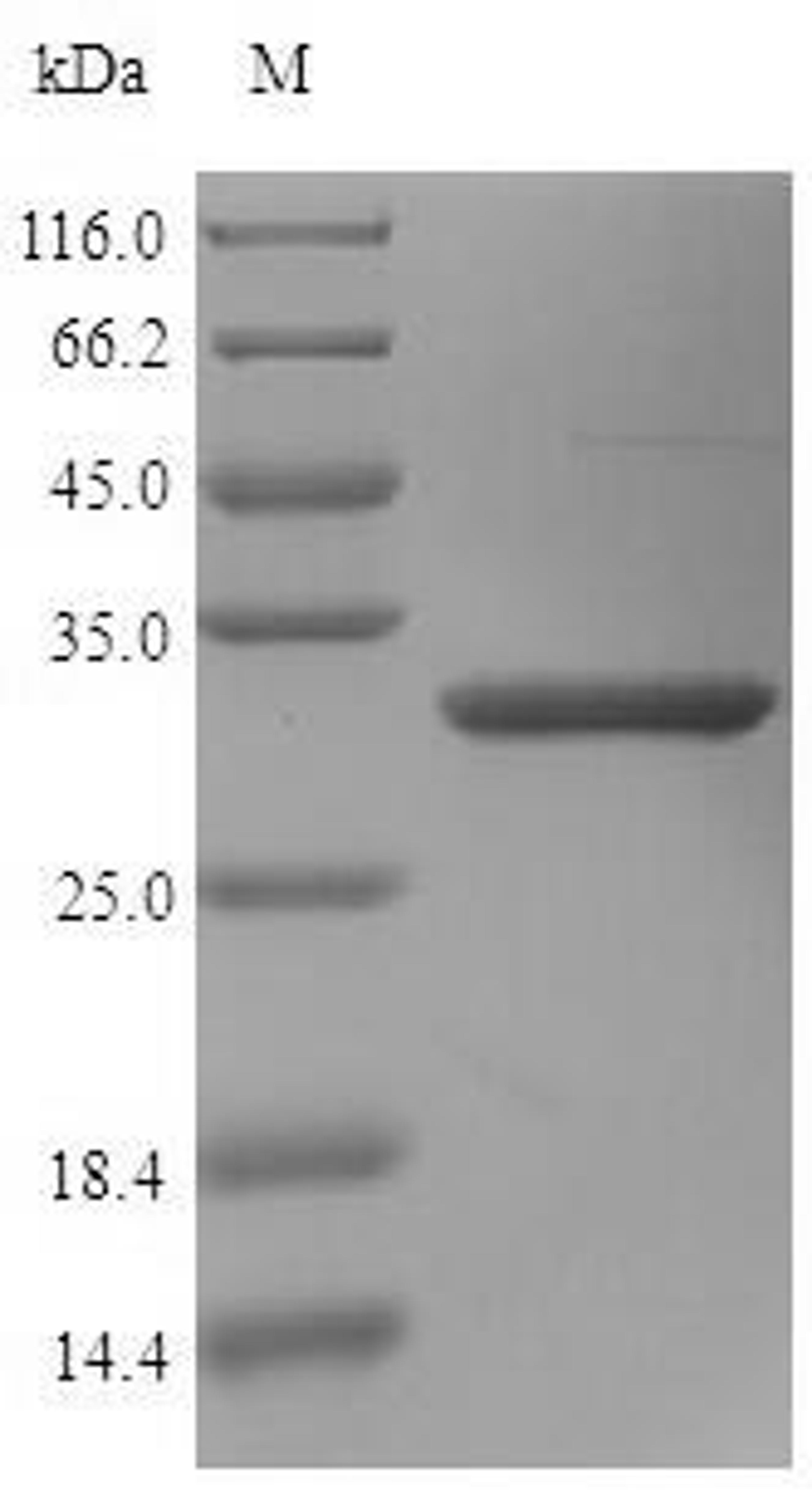 (Tris-Glycine gel) Discontinuous SDS-PAGE (reduced) with 5% enrichment gel and 15% separation gel.