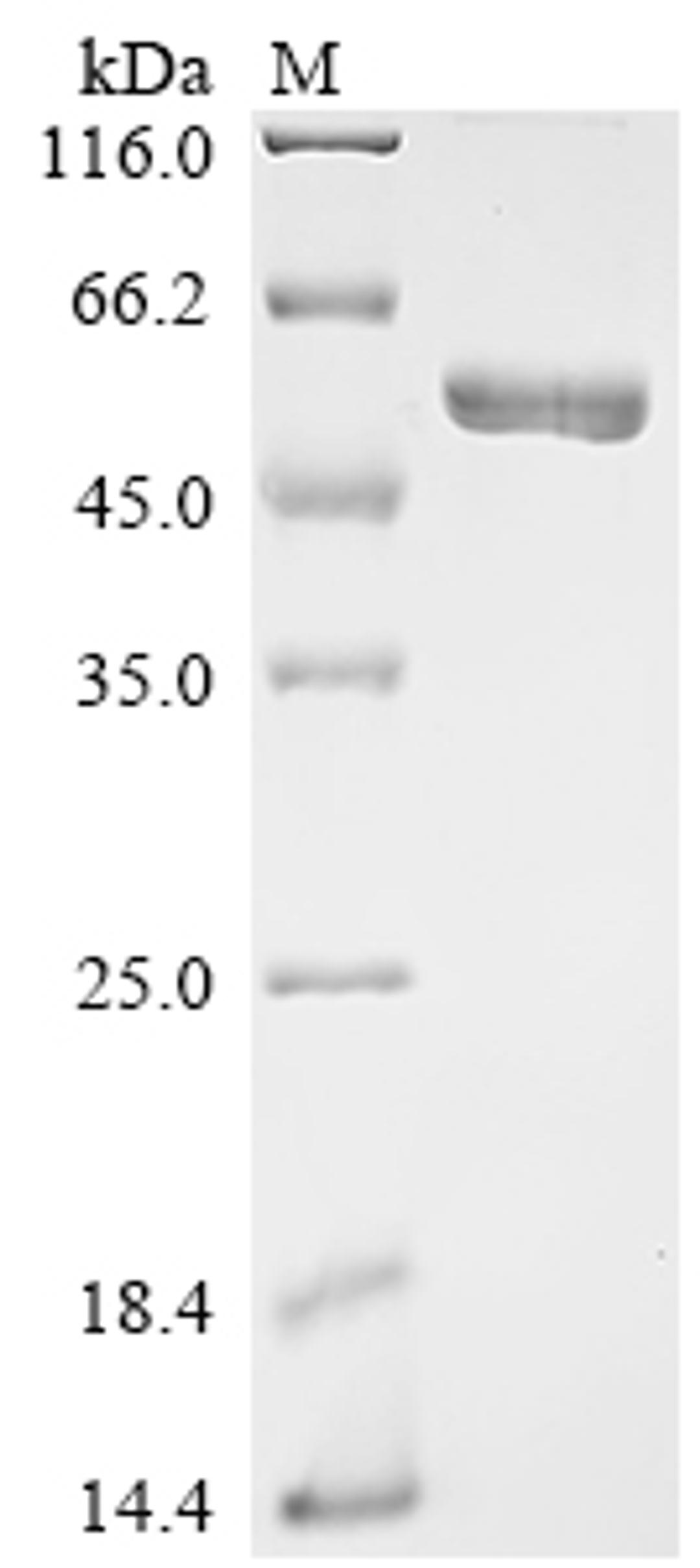(Tris-Glycine gel) Discontinuous SDS-PAGE (reduced) with 5% enrichment gel and 15% separation gel.