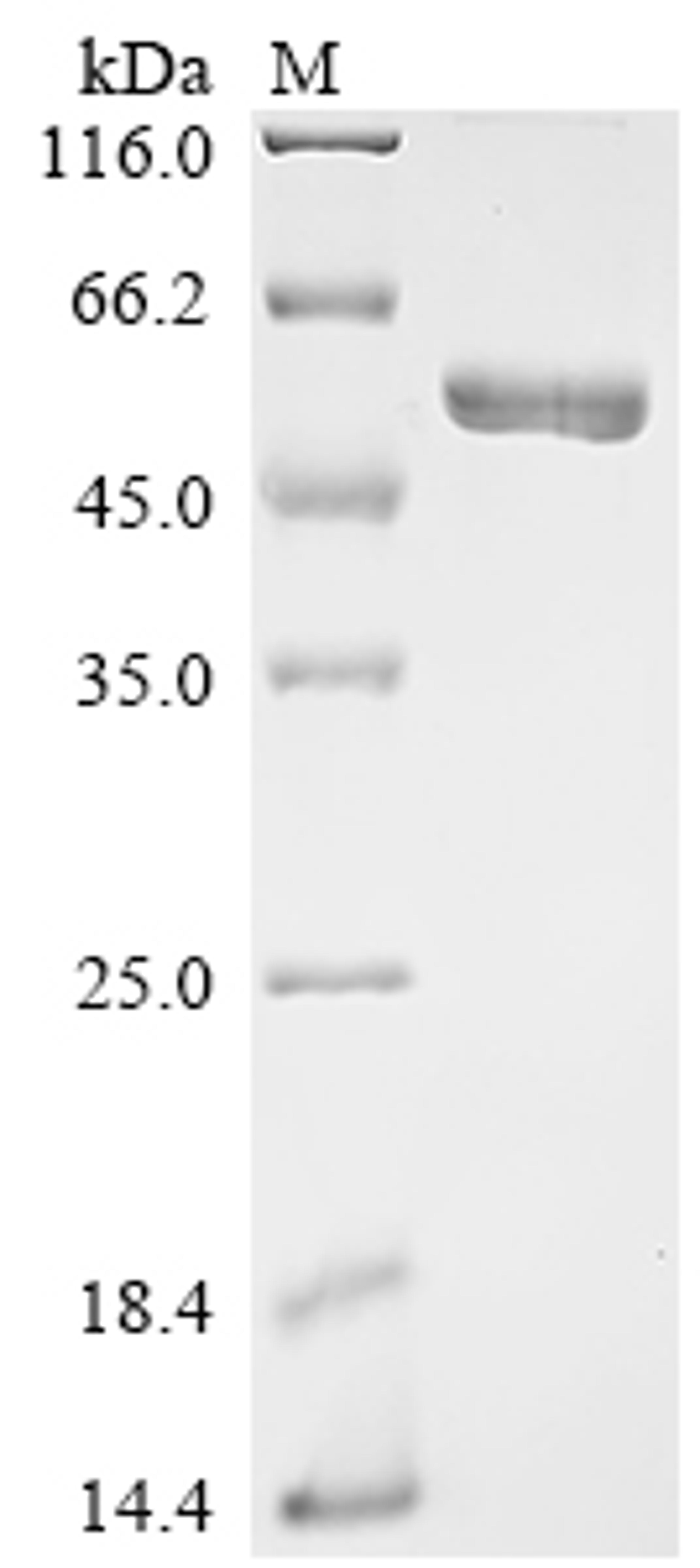 (Tris-Glycine gel) Discontinuous SDS-PAGE (reduced) with 5% enrichment gel and 15% separation gel.