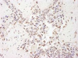 Detection of human MBD2 by immunohistochemistry.