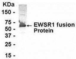 E coli-derived fusion protein as test antigen. Affinity-purified IgY dilution: 1:2000, Goat anti-IgY-HRP dilution: 1:1000. Colorimetric method for signal development.