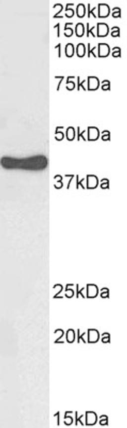 45-749 (0.003ug/ml) staining of Human Adrenal Gland lysate (35ug protein in RIPA buffer). Primary incubation was 1 hour. Detected by chemiluminescence.