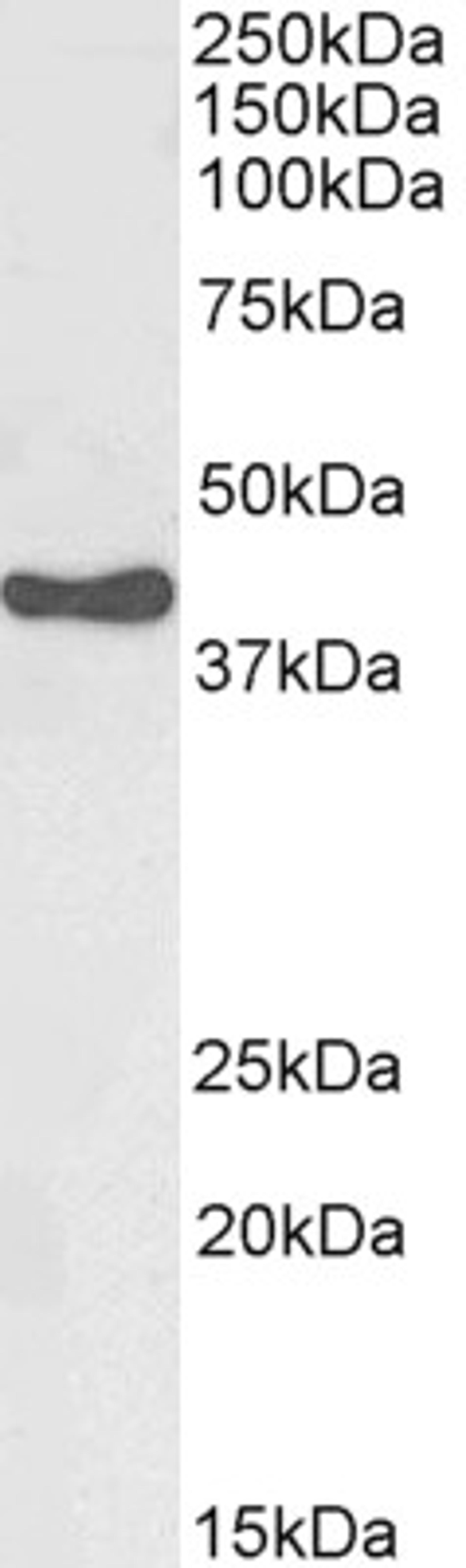 45-749 (0.003ug/ml) staining of Human Adrenal Gland lysate (35ug protein in RIPA buffer). Primary incubation was 1 hour. Detected by chemiluminescence.