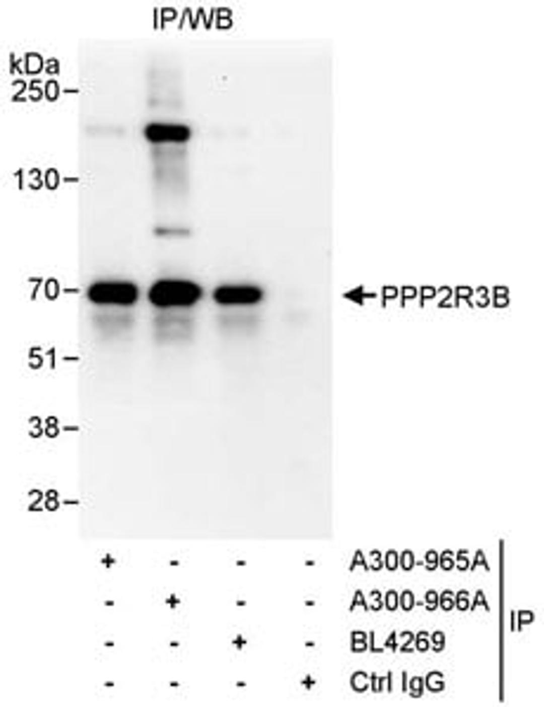 Detection of human PPP2R3B by western blot of immunoprecipitates.