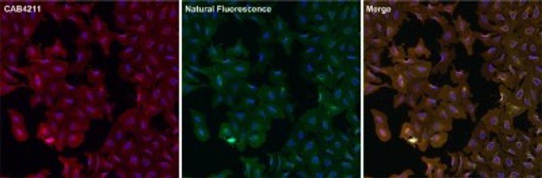 Immunocytochemistry/Immunofluorescence: eGFP Antibody [NBP2-37821] - Analysis of eGFP using either natural fluorescence (green) or an eGFP antibody (red) in U2OS cells transfected with an EGFR-eGFP fusion protein.