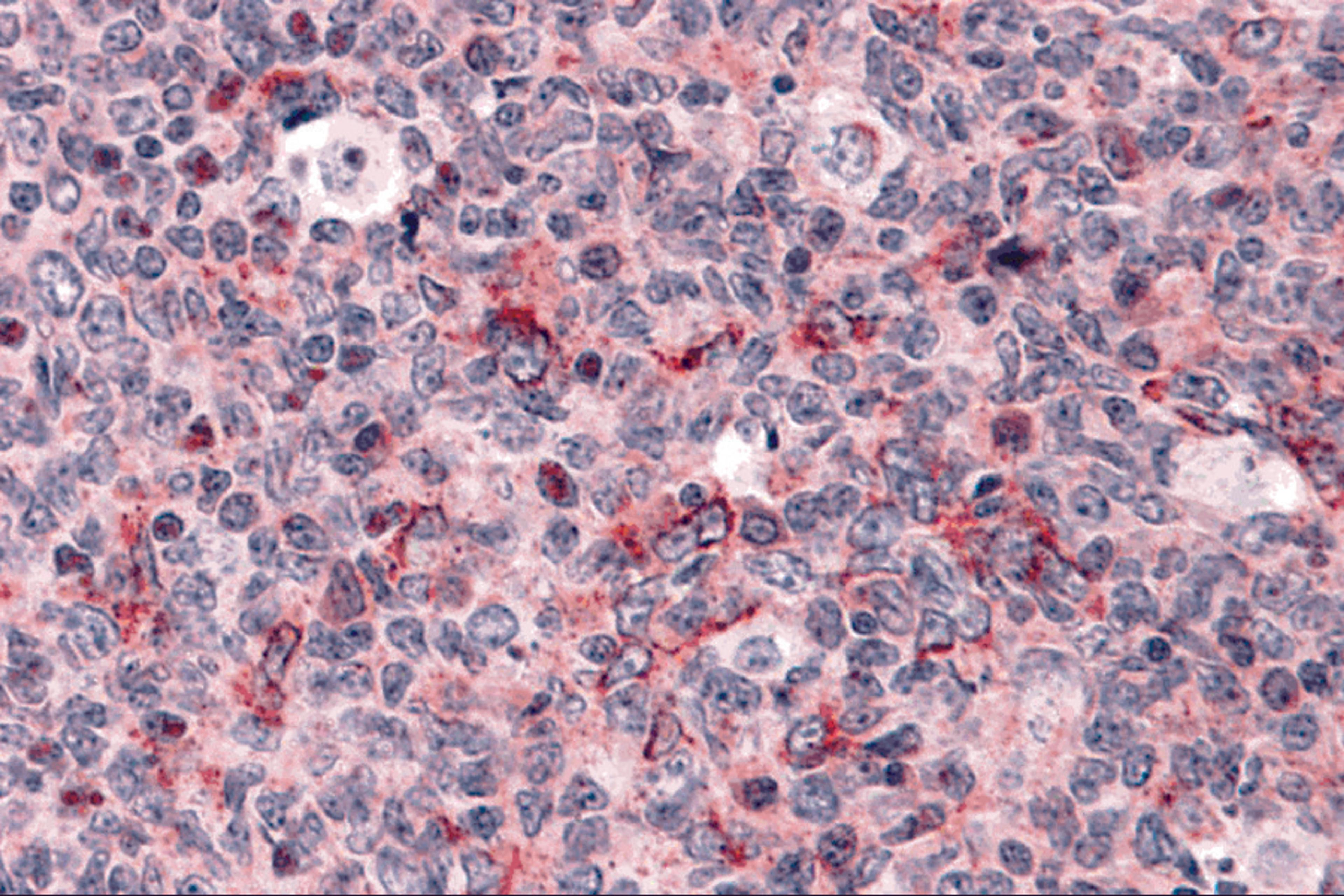 Immunohistochemistry of Caspase-3 in human tonsil tissue with Caspase-3 antibody at 5 &#956;g/mL.